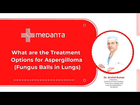  What are the Treatment Options for Aspergilloma (Fungus Balls in Lungs)? 